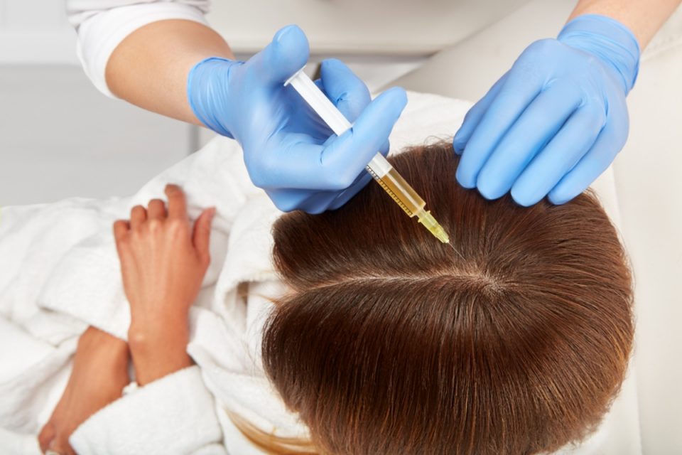 How Does Platelet Rich Plasma for Hair Regrowth Work